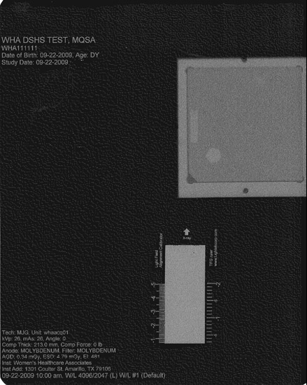 TFG Light Field Ruler x-ray image
